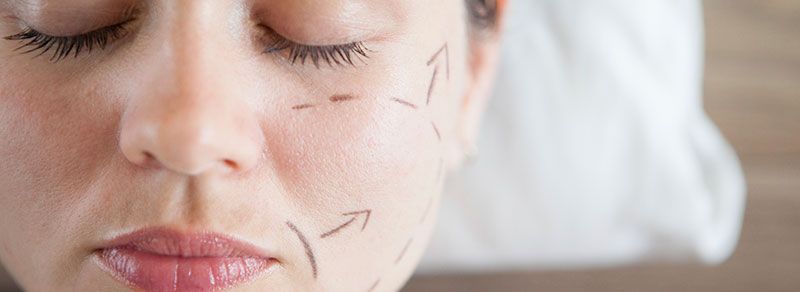 A woman with her eyes closed with dotted lines and arrows drawn on her face